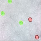 Sick Cells