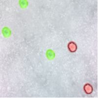 Sick Cells