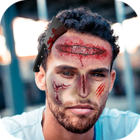 ACCIDENT PHOTO EDITOR: PRO APP