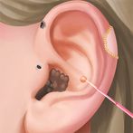 ASMR Hospital: Ear Master