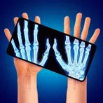 X-Ray Scanner - Metal Detector