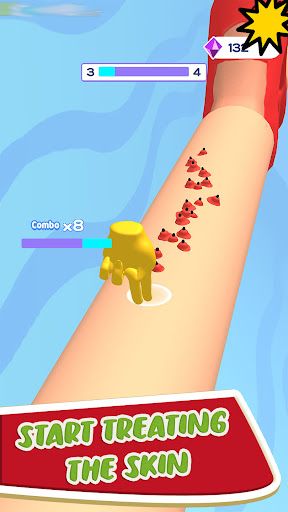 Pimple Squeezer Run Pop Popper - Screenshot 3