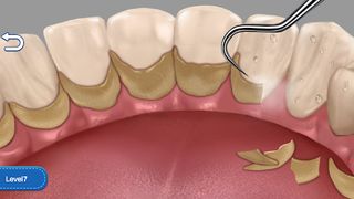 Clean Teeth Craze - Screenshot 3