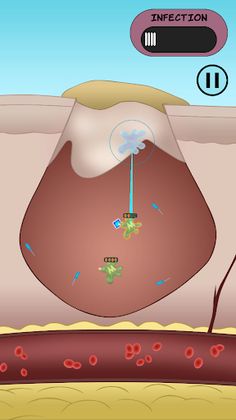 Dermis Defense - Screenshot 3