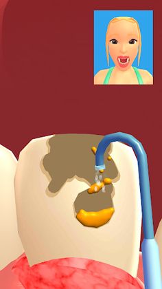 Teeth Digger 3D - Screenshot 4