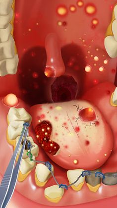 Happy Hospital®: ASMR Blast - Screenshot 3