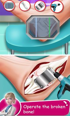 Foot Surgery Doctor Care ASMR - Screenshot 2