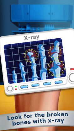 Foot Care: Offline Doctor Game - Screenshot 4