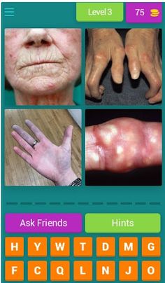 Guess the Disease: Doctor game - Screenshot 3