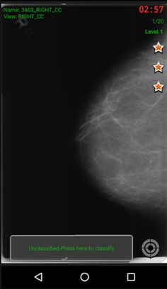 Mammo-X-Play2 - Screenshot 2