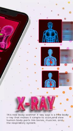 xray v3.0: xray scan simulator - Screenshot 2