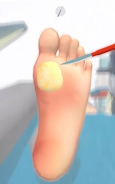 Foot Clinic - ASMR Feet Care - Screenshot 2