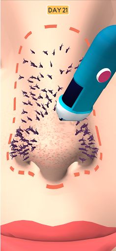 Nose Clean - Screenshot 1