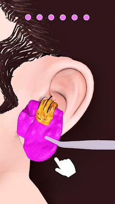 Earwax Removal - Screenshot 4