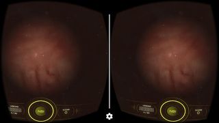 NBI VR by Olympus - Screenshot 1