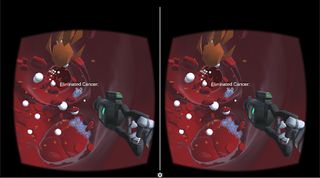 XCancer - VR Game - Screenshot 3