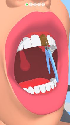 Perfect Smile - Screenshot 1