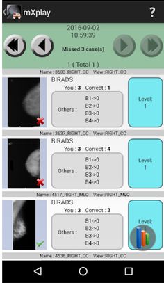 Mammo-X-Play2 - Screenshot 3