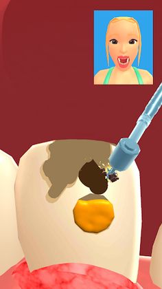 Teeth Digger 3D - Screenshot 3