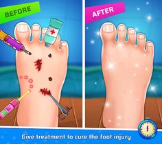 Foot Surgery Games Offline - Screenshot 3