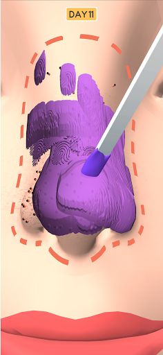 Nose Clean - Screenshot 3