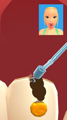 Teeth Digger 3D - Screenshot 2