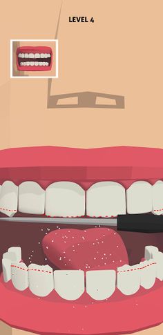 Sharp Toother - Screenshot 1