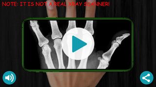 X-Ray Scanner Simulator Prank - Screenshot 1