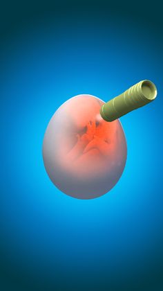 Hatching Master - Screenshot 4