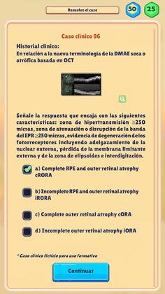 OftalmoGame - Screenshot 2