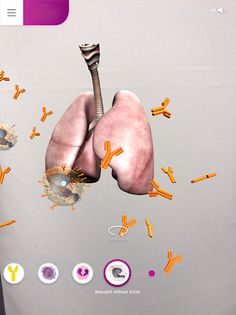 Allergic Asthma - Screenshot 2