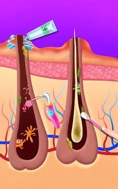 Makeup Artist - Pimple Salon - Screenshot 3