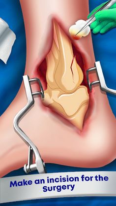 Foot Doctor Clinic ASMR Games - Screenshot 4