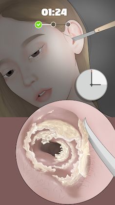 Ear Cleaning Master - Screenshot 1