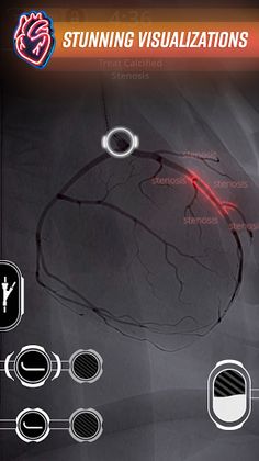 CardioEX - Screenshot 1